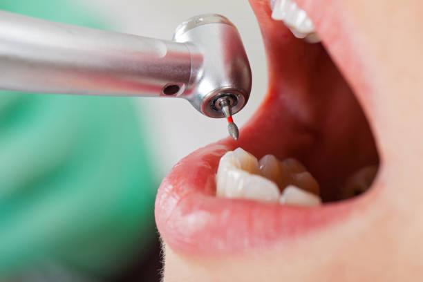 Best Emergency Treatment for Toothache in Auburn, IN